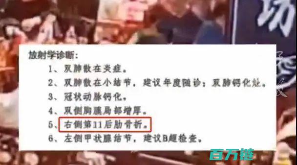 老人婚宴不慎摔断肋骨 酒店仅赔顿饭引发不满 (老人参加婚礼)