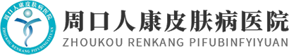 河南治疗牛皮癣的医院_30年牛皮癣治疗经验-人康医院